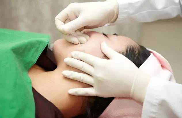 祛皺逆齡，黃金線(xiàn)雕的回春優(yōu)勢(shì)