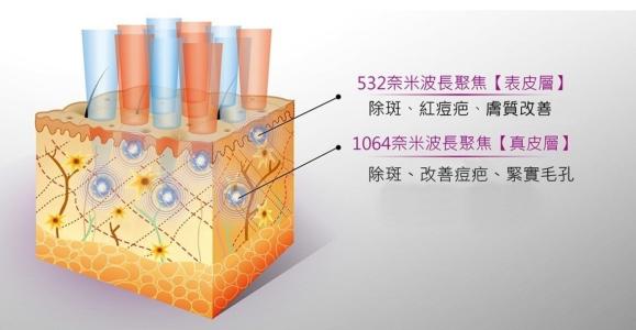 祛痘我用點(diǎn)陣，你呢？！